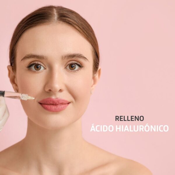 Relleno Ácido Hialurónico en Marbella, Estética Ochoa