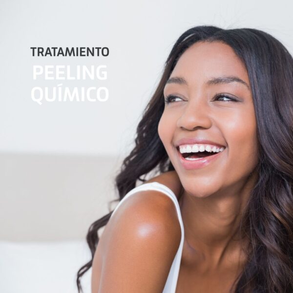 Tratamiento de Peeling Químico en Estética Ochoa en Marbella