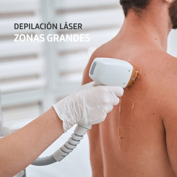Depilación Láser Zonas Grandes